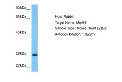 MRPL16 Rabbit anti-Mouse, Polyclonal, Novus Biologicals 0.1 mL | Buy Online | Novus Biologicals | Fisher Scientific